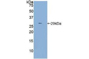 Western blot analysis of recombinant Rat TLR4. (TLR4 anticorps  (AA 49-247))