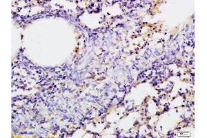 Formalin-fixed and paraffin embedded rat lung tissue labeled with Rabbit Anti-SGLT1 Polyclonal Antibody, Unconjugated 1:200 followed by conjugation to the secondary antibody and DAB staining