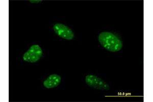 Immunofluorescence of purified MaxPab antibody to ZNF593 on HeLa cell. (ZNF593 anticorps  (AA 1-116))