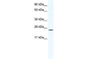 BRF1 antibody (20R-1153) used at 2. (BRF1 anticorps  (C-Term))
