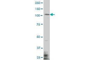 EHMT1 monoclonal antibody (M04), clone 1H2 Western Blot analysis of EHMT1 expression in MES-SA/Dx5 . (EHMT1 anticorps  (AA 1-100))