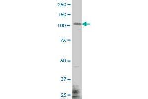 EHMT1 monoclonal antibody (M04), clone 1H2 Western Blot analysis of EHMT1 expression in MES-SA/Dx5 .
