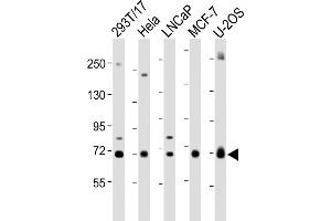 All lanes : Anti-GC Antibody (Center) at 1:2000 dilution Lane 1: 293T/17 whole cell lysate Lane 2: Hela whole cell lysate Lane 3: LNCaP whole cell lysate Lane 4: MCF-7 whole cell lysate Lane 5: U-2OS whole cell lysate Lysates/proteins at 20 μg per lane. (Gc (AA 337-365), (Center) anticorps)