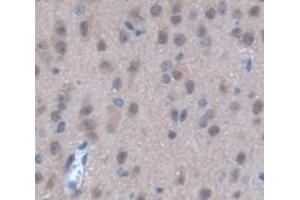 IHC-P analysis of Kidney tissue, with DAB staining. (STK3 anticorps  (AA 235-460))