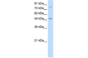 WB Suggested Anti-FOXB1 Antibody Titration:  5. (FOXB1 anticorps  (N-Term))