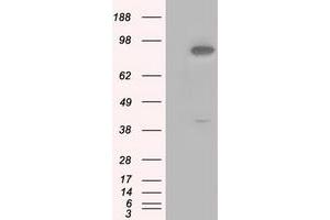 Image no. 4 for anti-Betaine--Homocysteine S-Methyltransferase (BHMT) antibody (ABIN1496917) (BHMT anticorps)