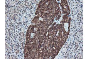 Image no. 5 for anti-SKI-Like Oncogene (SKIL) (AA 307-684) antibody (ABIN1491380)