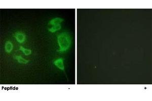 Immunofluorescence analysis of HepG2 cells, using ZAK polyclonal antibody . (ZAK anticorps  (C-Term))