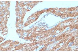 Immunohistochemistry of paraffin-embedded Mouse heart using ACSL3 Polyclonal Antibody at dilution of 1:100 (40x lens). (Acsl3 anticorps)