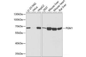 Western blot analysis of extracts of various cell lines using PGM1 Polyclonal Antibody at dilution of 1:1000. (Phosphoglucomutase 1 anticorps)