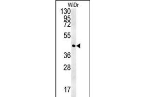 CCYL1 Antibody (N-term) (ABIN651917 and ABIN2840452) western blot analysis in WiDr cell line lysates (35 μg/lane). (CCNYL1 anticorps  (N-Term))