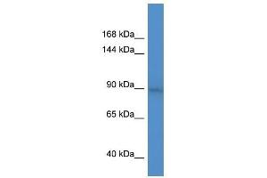 BCL11A antibody used at 0. (BCL11A anticorps  (C-Term))