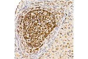 Immunohistochemistry of paraffin-embedded rat ovary using [KO Validated] DNMT1 Rabbit mAb (ABIN7266808) at dilution of 1:100 (40x lens).