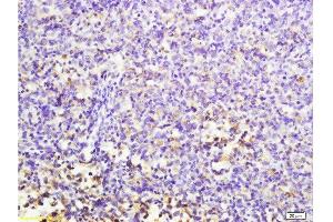 Formalin-fixed and paraffin embedded mouse lymphoma labeled with Anti-MuRF1/Trim63 Polyclonal Antibody, Unconjugated  at 1:200 followed by conjugation to the secondary antibody and DAB staining. (CD7 anticorps  (AA 181-240))