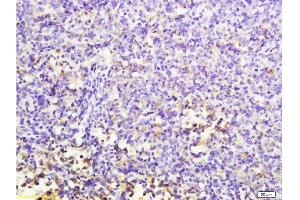 Formalin-fixed and paraffin embedded mouse lymphoma labeled with Anti-MuRF1/Trim63 Polyclonal Antibody, Unconjugated  at 1:200 followed by conjugation to the secondary antibody and DAB staining.