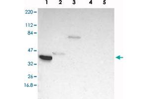 Western blot analysis of Lane 1: RT-4, Lane 2: U-251 MG, Lane 3: Human Plasma, Lane 4: Liver, Lane 5: Tonsil with TFAP4 polyclonal antibody . (TFAP4 anticorps)