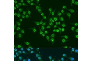 Immunofluorescence analysis of U2OS cells using KLF4 Polyclonal Antibody at dilution of 1:100.