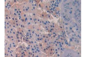 IHC-P analysis of Rat Adrenal gland Tissue, with DAB staining. (PIGR anticorps  (AA 343-447))