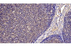 #VALUE! (IL4 Receptor anticorps  (AA 26-232))