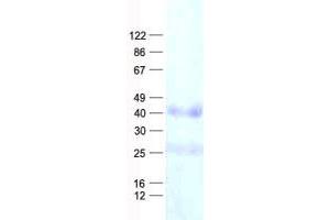 Validation with Western Blot (LRRC17 Protein (His tag))