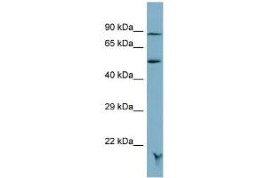 Host:  Rabbit  Target Name:  MRAP  Sample Type:  OVCAR-3 Whole cell lysates  Antibody Dilution:  1. (MRAP anticorps  (N-Term))