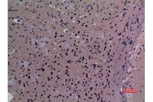 Immunohistochemistry (IHC) analysis of paraffin-embedded Mouse Brain, antibody was diluted at 1:100.