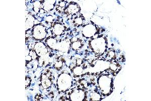 Immunohistochemistry of paraffin-embedded rat brown adipose using PPARγ Rabbit pAb (ABIN6134090, ABIN6146004, ABIN6146006 and ABIN6215096) at dilution of 1:250 (40x lens). (PPARG anticorps  (AA 70-170))