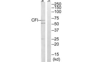 Western blot analysis of extracts from Jurkat cells, using CFI antibody. (Complement Factor I anticorps  (Internal Region))