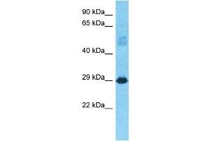 Host:  Rabbit  Target Name:  CJ076  Sample Type:  Fetal Liver lysates  Antibody Dilution:  1. (C10orf76 anticorps  (C-Term))