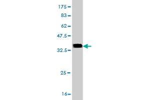 Western Blot detection against Immunogen (35. (CDK4 anticorps  (AA 211-303))