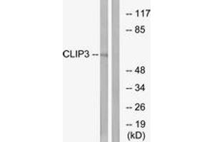 Western Blotting (WB) image for anti-CAP-GLY Domain Containing Linker Protein 3 (CLIP3) (AA 361-410) antibody (ABIN2890180) (CLIP3 anticorps  (AA 361-410))