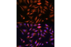 Immunofluorescence analysis of HeLa cells using FBP1 Rabbit mAb (ABIN7267269) at dilution of 1:100 (40x lens). (FBP1 anticorps)