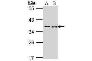 BCCIP anticorps  (C-Term)