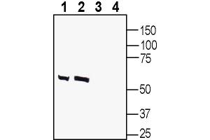 Western blot analysis of human SH-SY5Y neuroblastoma cell line lysate (lanes 1 and 3) and human  MG glioblastoma cell line lysate (lanes 2 and 4):1-2.