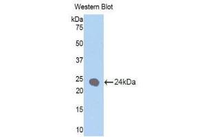 Western Blotting (WB) image for anti-Keratin 1 (KRT1) (AA 350-488) antibody (ABIN1172987)