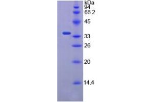 SDS-PAGE of Protein Standard from the Kit (Highly purified E. (E-cadherin Kit CLIA)