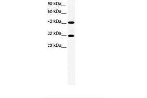 Image no. 1 for anti-General Transcription Factor IIH, Polypeptide 2, 44kDa (GTF2H2) (AA 299-348) antibody (ABIN202422) (GTF2H2 anticorps  (AA 299-348))