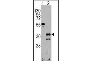 Western blot analysis of ZIC4 (arrow) using rabbit polyclonal ZIC4 Antibody (C-term) (ABIN389183 and ABIN2839346). (ZIC4 anticorps  (C-Term))