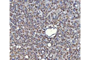 IHC analysis of SAV1 using anti-SAV1 antibody (ABIN7602478). (SAV1 anticorps  (AA 8-320))