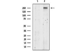 anti-Zinc Finger Protein 462 (ZNF462) antibody