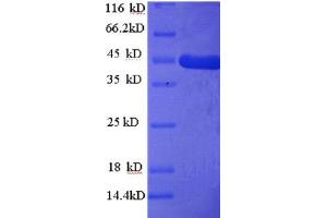 Homer Homolog 1 (Drosophila) (HOMER1) (AA 1-354), (full length) protein (His tag)