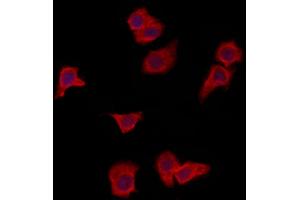 ABIN6265998 and ABIN6273087 staining HepG2 by IF/ICC. (VPS37A anticorps  (N-Term))