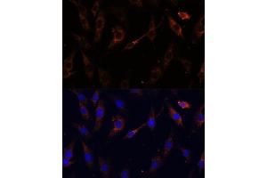 Immunofluorescence analysis of C6 cells using VPS25 Polyclonal Antibody (ABIN6128913, ABIN6150122, ABIN6150123 and ABIN6217011) at dilution of 1:100 (40x lens). (VPS25 anticorps  (AA 1-176))