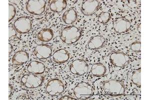 Image no. 4 for anti-Glutaminyl-tRNA Synthetase (QARS) (AA 677-776) antibody (ABIN598566) (QARS anticorps  (AA 677-776))