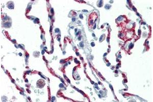 Human Lung (formalin-fixed, paraffin-embedded) stained with CD34 antibody ABIN461990 at 1:50 followed by biotinylated anti-mouse IgG secondary antibody ABIN481714, alkaline phosphatase-streptavidin and chromogen. (CD34 anticorps  (FITC))