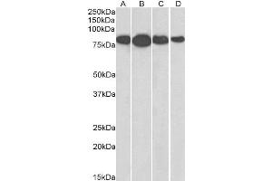 ABIN2564861 (0. (Radixin anticorps  (Internal Region))