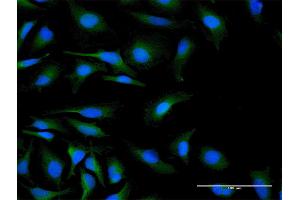 Immunofluorescence of purified MaxPab antibody to C19orf10 on HeLa cell. (C19orf10 anticorps  (AA 1-173))