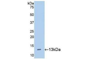 Detection of Recombinant Hepc, Mouse using Polyclonal Antibody to Hepcidin (Hepc)