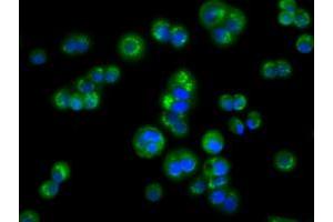 Image no. 5 for anti-Acetyl-CoA Acetyltransferase 2 (ACAT2) antibody (ABIN1496401) (ACAT2 anticorps)