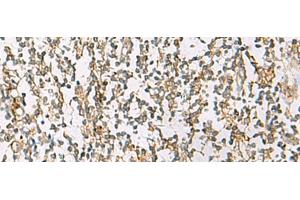 Immunohistochemistry of paraffin-embedded Human tonsil tissue using ZPBP2 Polyclonal Antibody at dilution of 1:80(x200) (ZPBP2 anticorps)